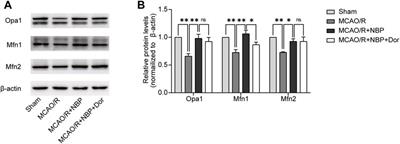 Dl-3-n-butylphthalide attenuates cerebral ischemia/reperfusion injury in mice through AMPK-mediated mitochondrial fusion